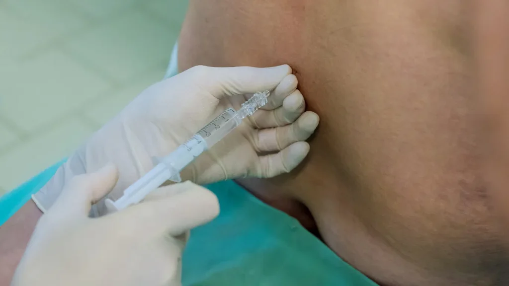 Epidural Steroid Injections in Phoenix