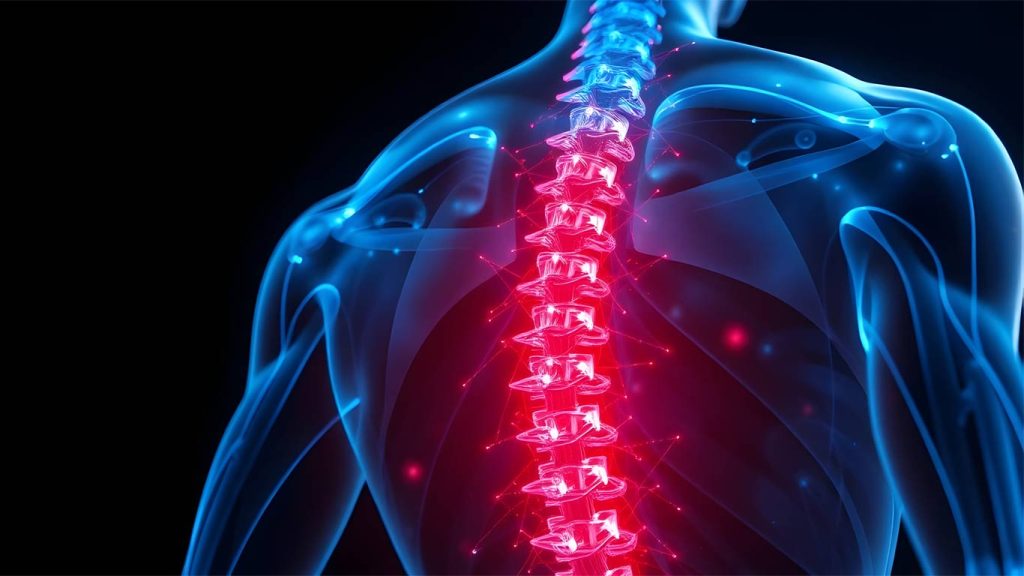 Facet Rhizotomy in Phoenix