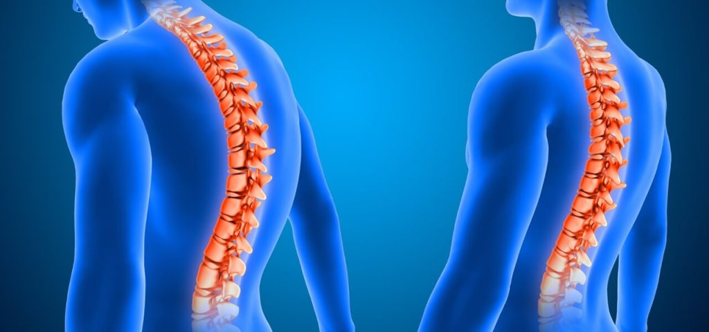 Degenerative Disc Disease Treatments Scottsdale