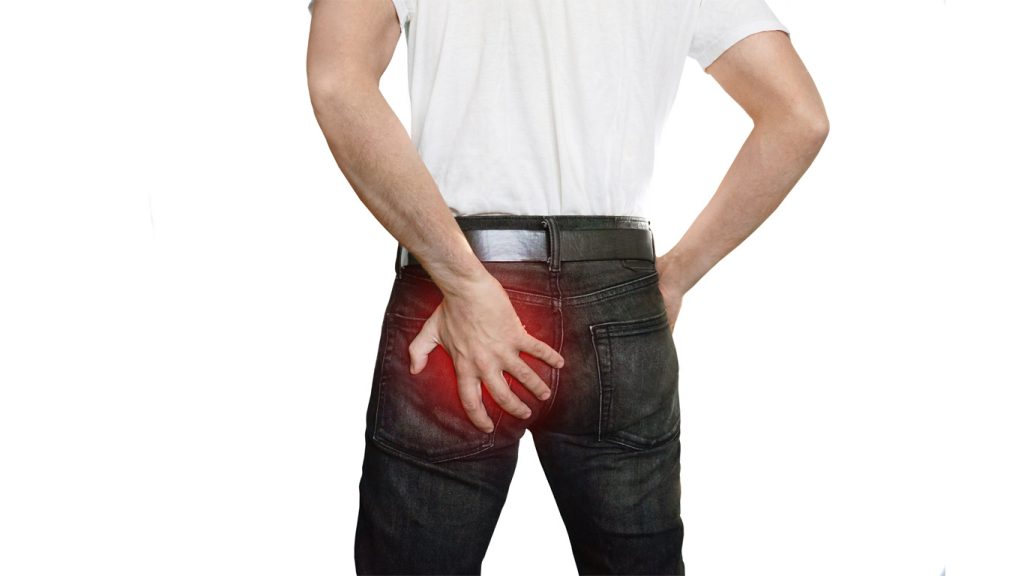 Piriformis Syndrome Treatment Scottsdale